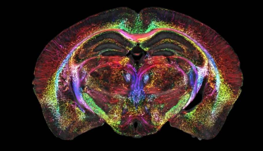 نگاه جدیدی به مغز: محققان موفق به ثبت اسکن‌هایی ۶۴ میلیون بار واضح تر از قبل شدند