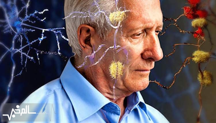 مشکل ساز شدن کمبود دارو برای بیماران آلزایمری