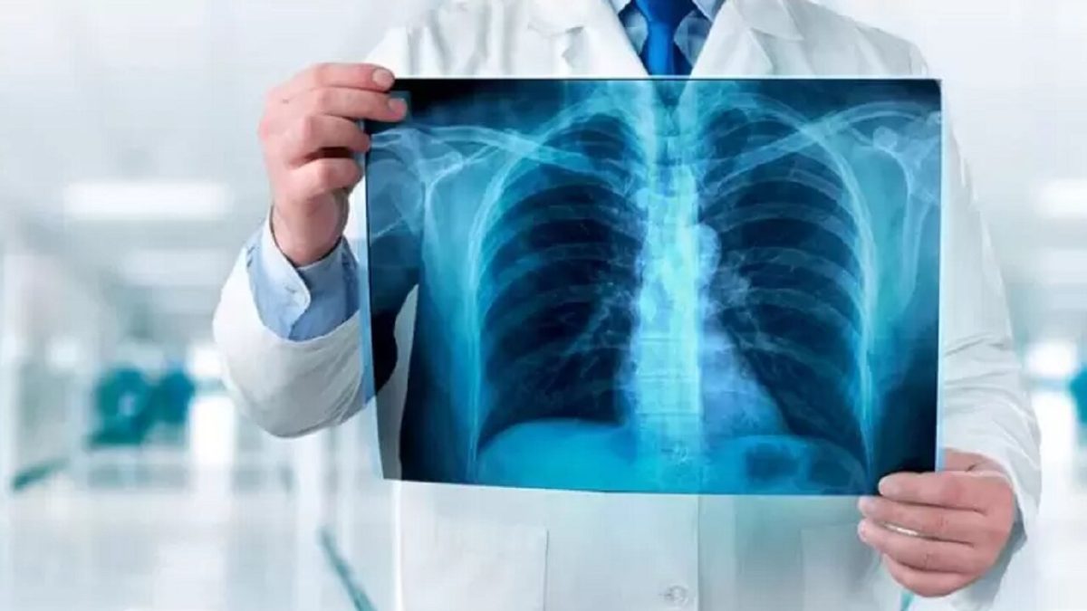 چه میزان از اشعه ایکس خطرناک است؟