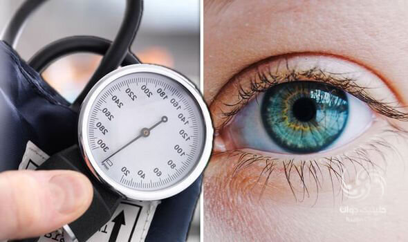 فشار خون بالا چطور سلامت چشم‌ها را تهدید می‌کند؟