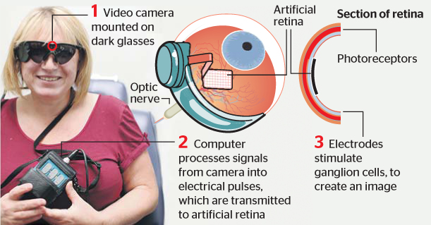 ساخت چشم مصنوعی در مهندسی پزشکی